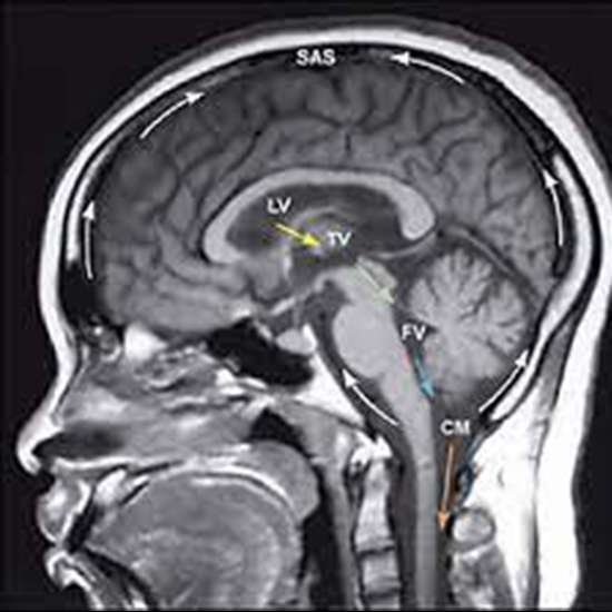 Is Getting Brain MRI Scan A Painful Procedure